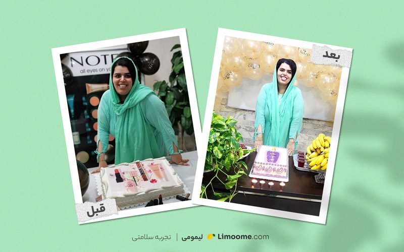 قبل و بعد لاغری